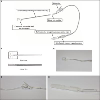 The Third Hand of Neurosurgeons – a novel intraoperative malleable adjustable continuous suction tube